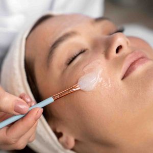 Chemical Peels Treatment