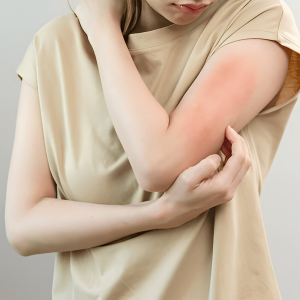 Redness and Irritation - waxing side effects