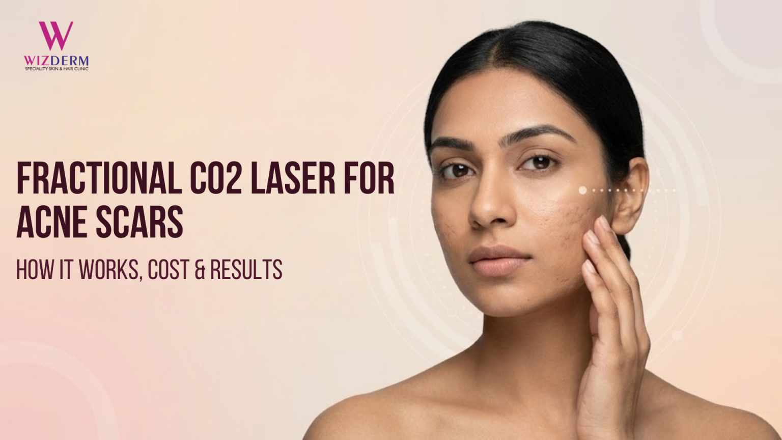 Fractional CO₂ Laser for Acne Scars: How It Works, Cost & Results - Fractional Co2 Laser For Acne Scars