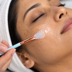 Chemical Peels